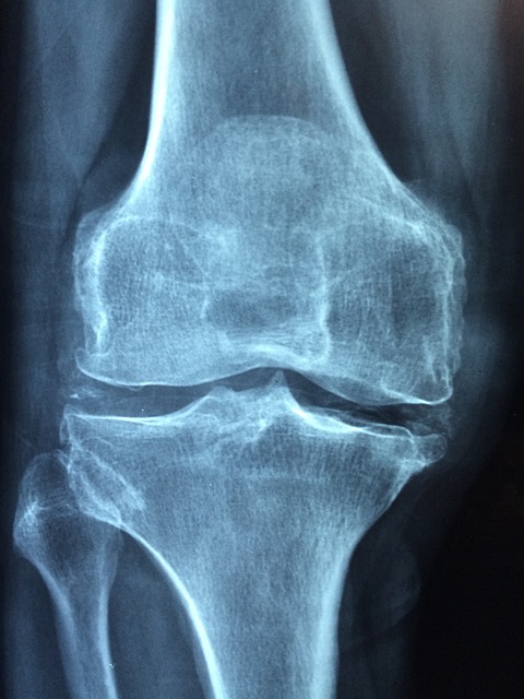 관절을 강화하다: 무릎 마사지의 치유적 효능